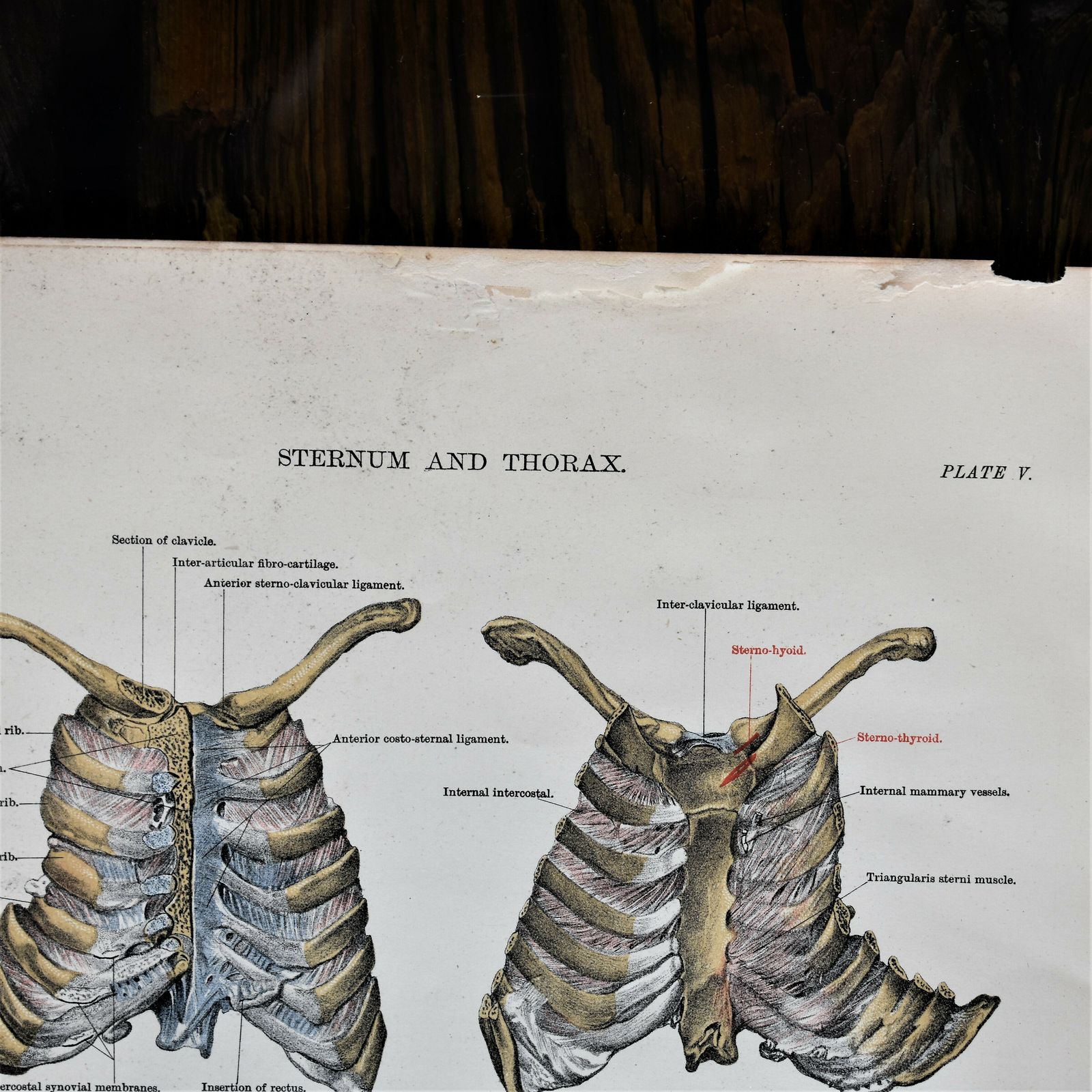 345.0 Antique 1885 W & Ak Johnston Human Pelvis Thorax Plate Print Museum Frame Pair photo
