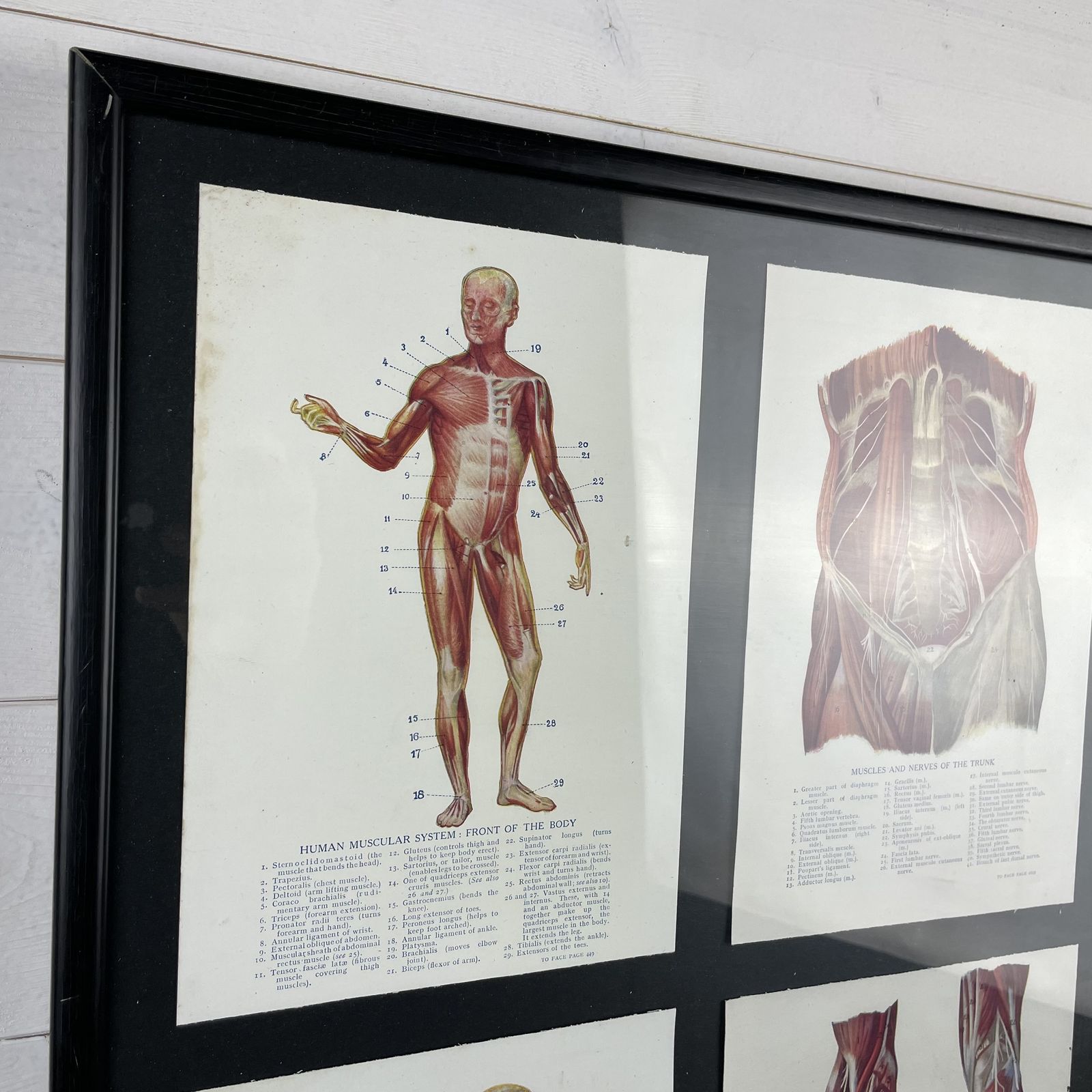 Vintage Framed Medical Anatomy Prints photo furniture