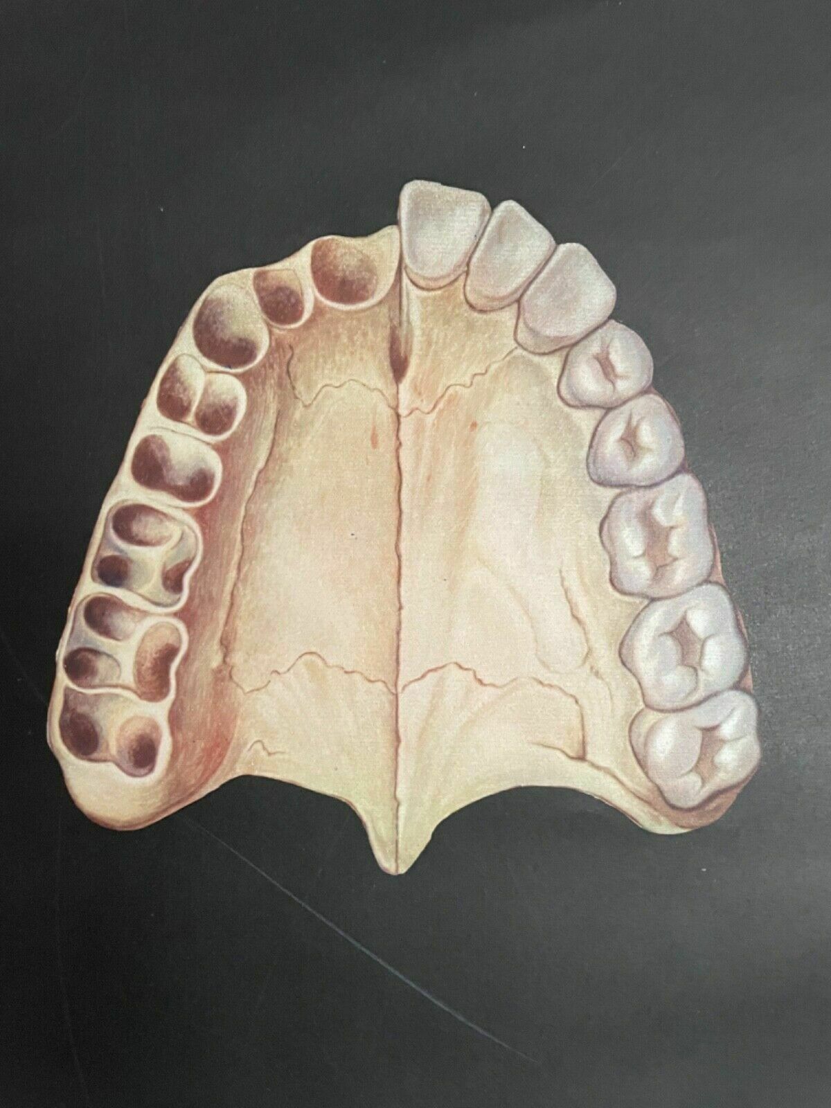 141.0 Vintage School Chart Of Teeth Dental Anatomy Educational Chart Line Poster Tooth photo
