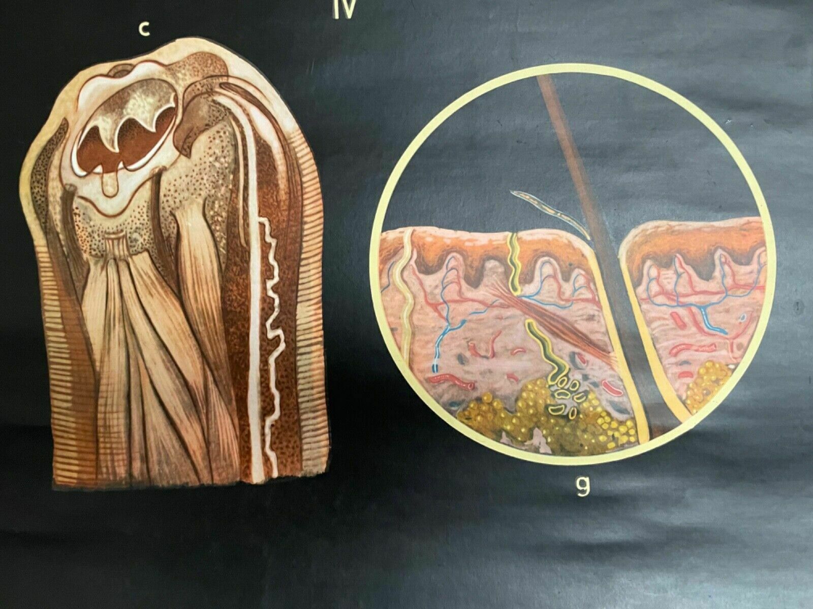Vintage Gut Parasites Roll Down Educational School Chart Wall Chart Trichinosis photo vinterior
