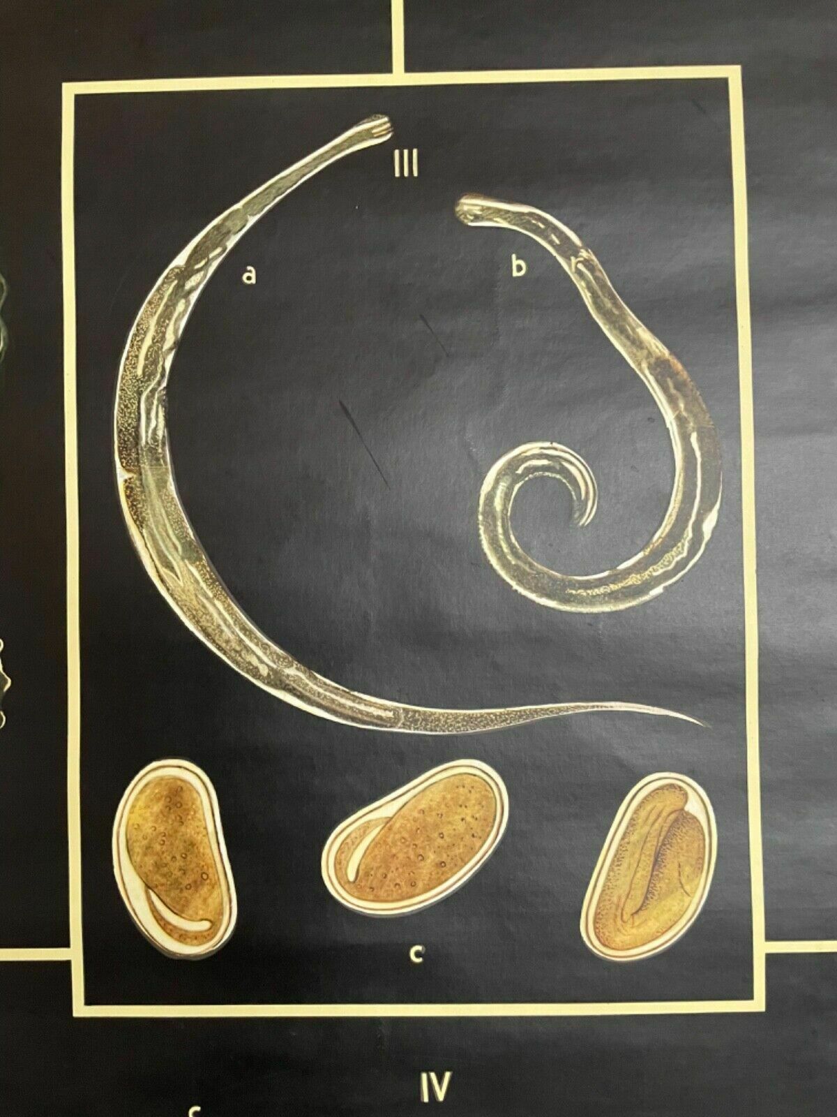 Vintage Gut Parasites Roll Down Educational School Chart Wall Chart Trichinosis photo buy
