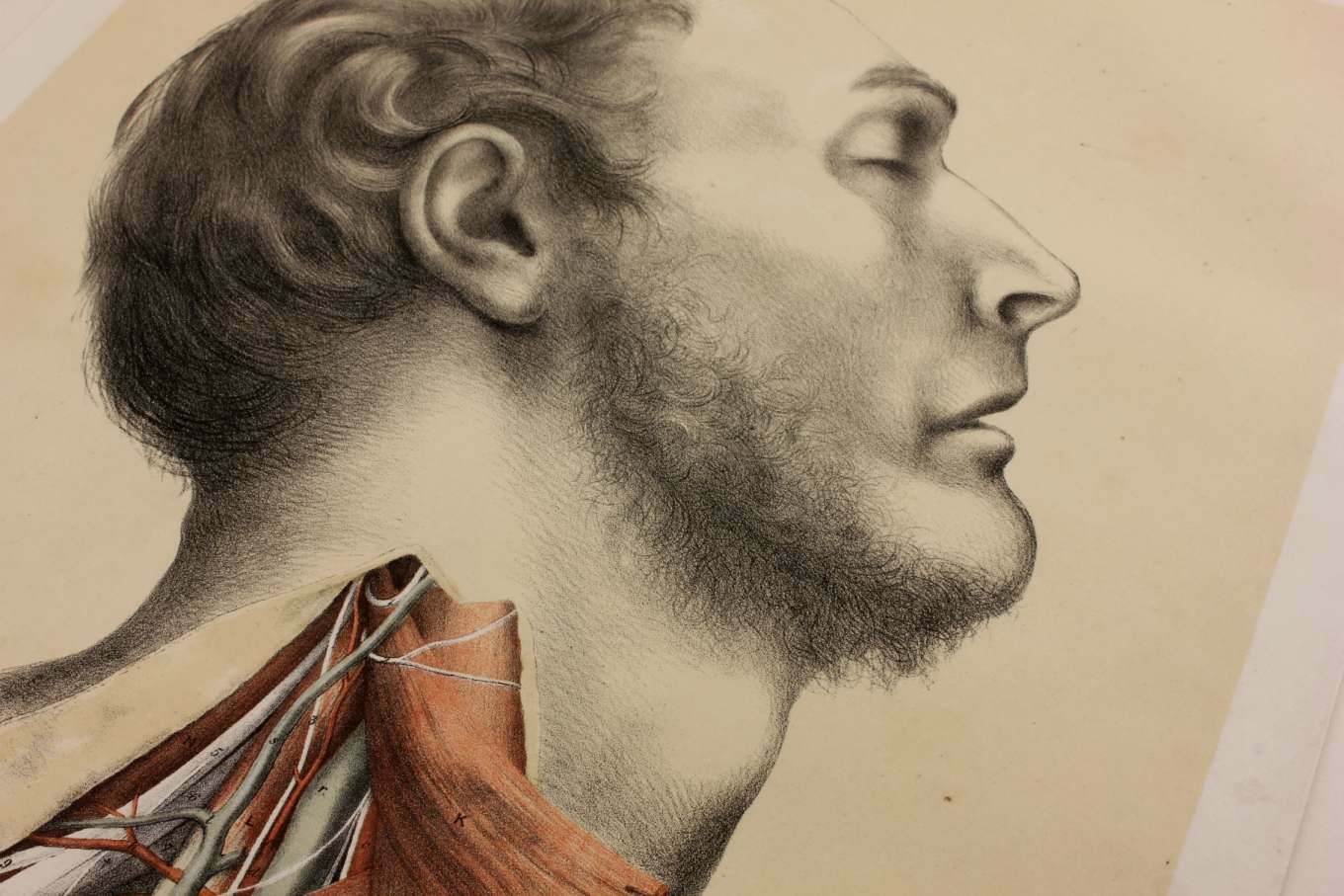 Original G Ellis Anatomy Lithograph Illustration Of Neck Dissection. 1864. photo Art