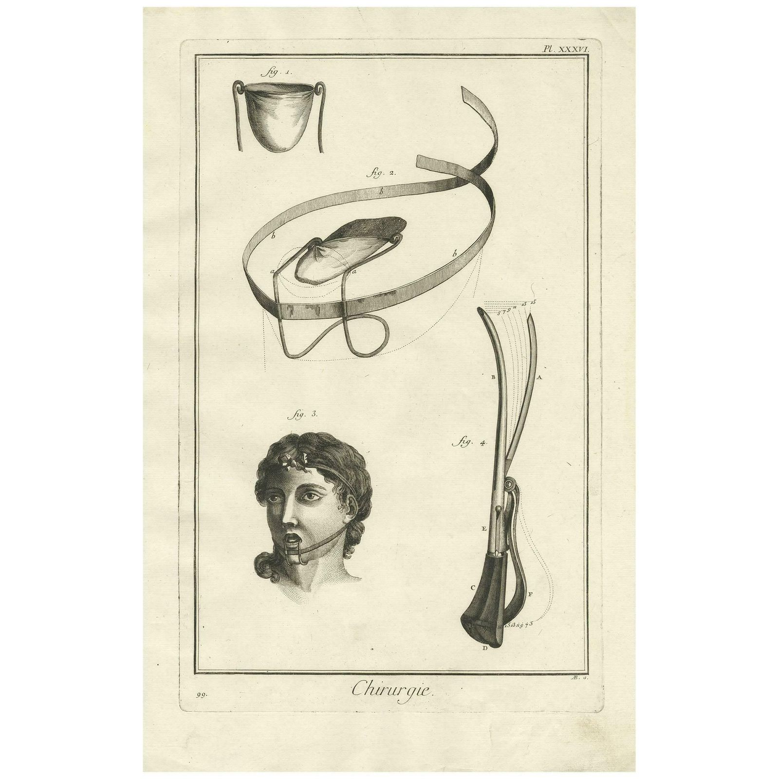 Antique Medical Print 'Pl. Xxxvi' By D. Diderot, Circa 1760