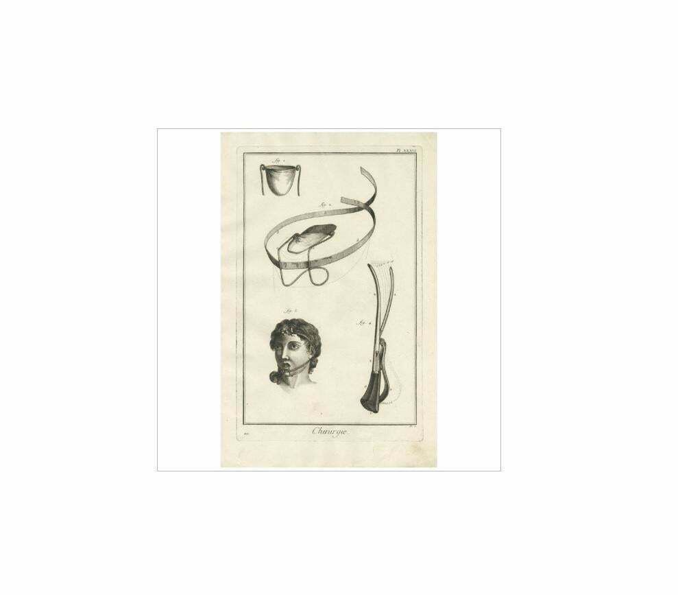 Antique Medical Print 'Pl. Xxxvi' By D. Diderot, Circa 1760 photo Art