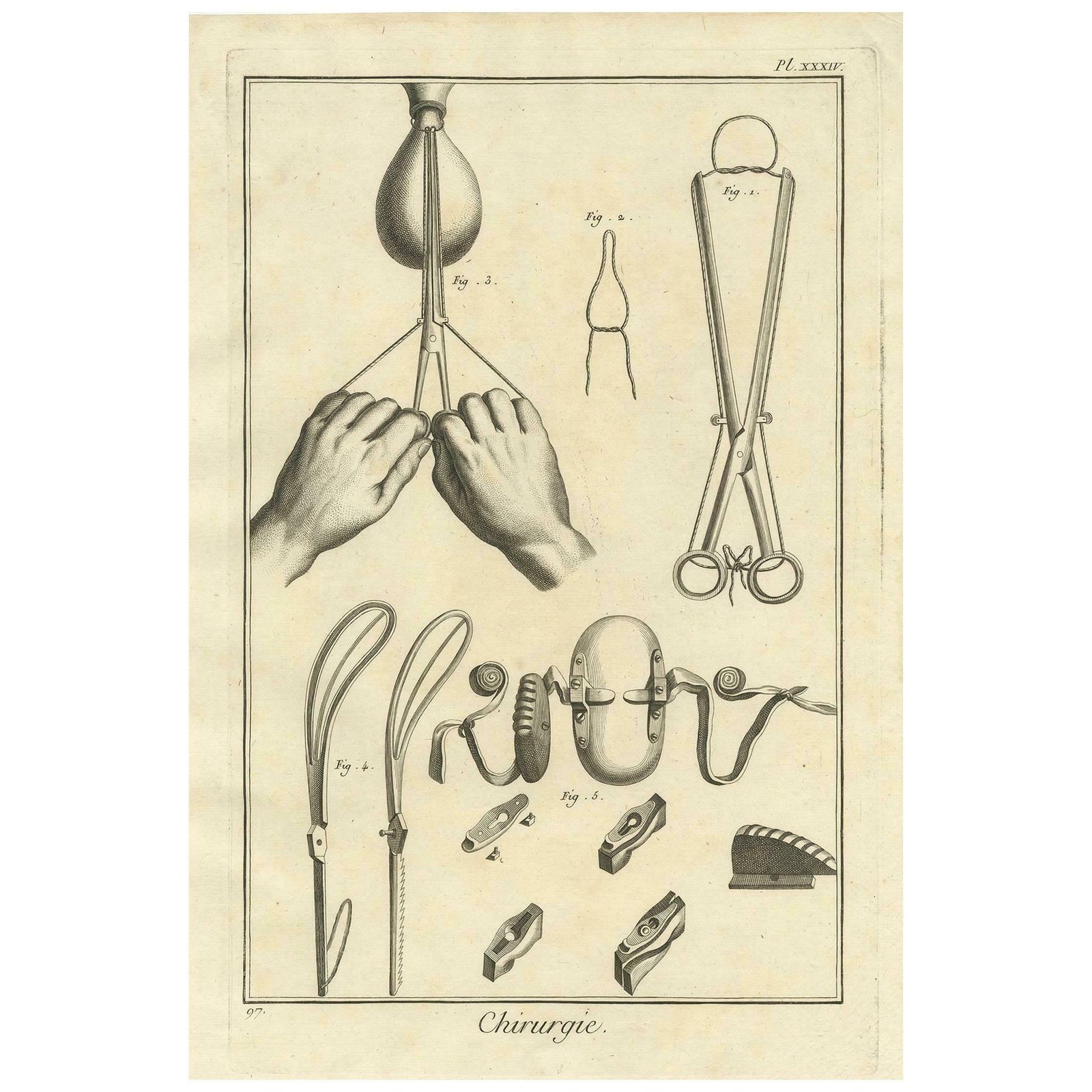Antique Medical Print Pl. Xxxiv' By D. Diderot Circa 1760