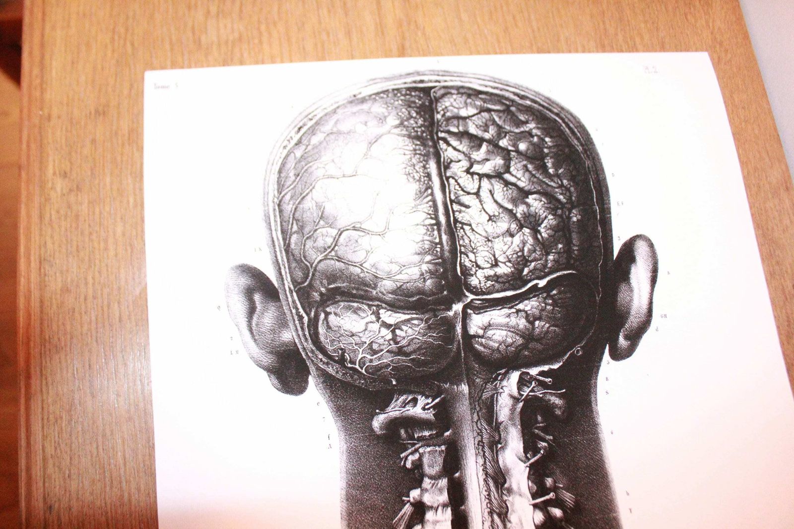 Rare Anatomical Giclée Print. Large Wall Art. Anatomical Print 1m Tall. Very Limited Edition. photo vinterior