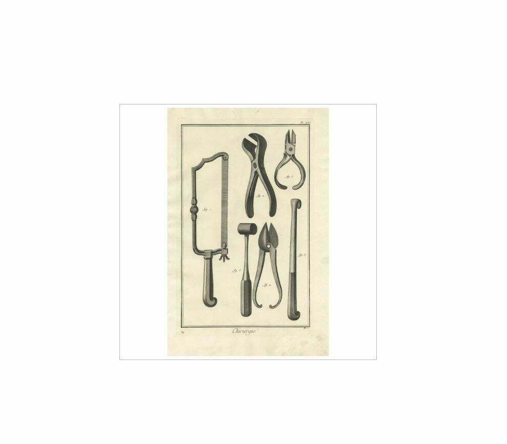 Antique Medical Print ‘Pl. Xxi’ By D. Diderot, Circa 1760 photo furniture