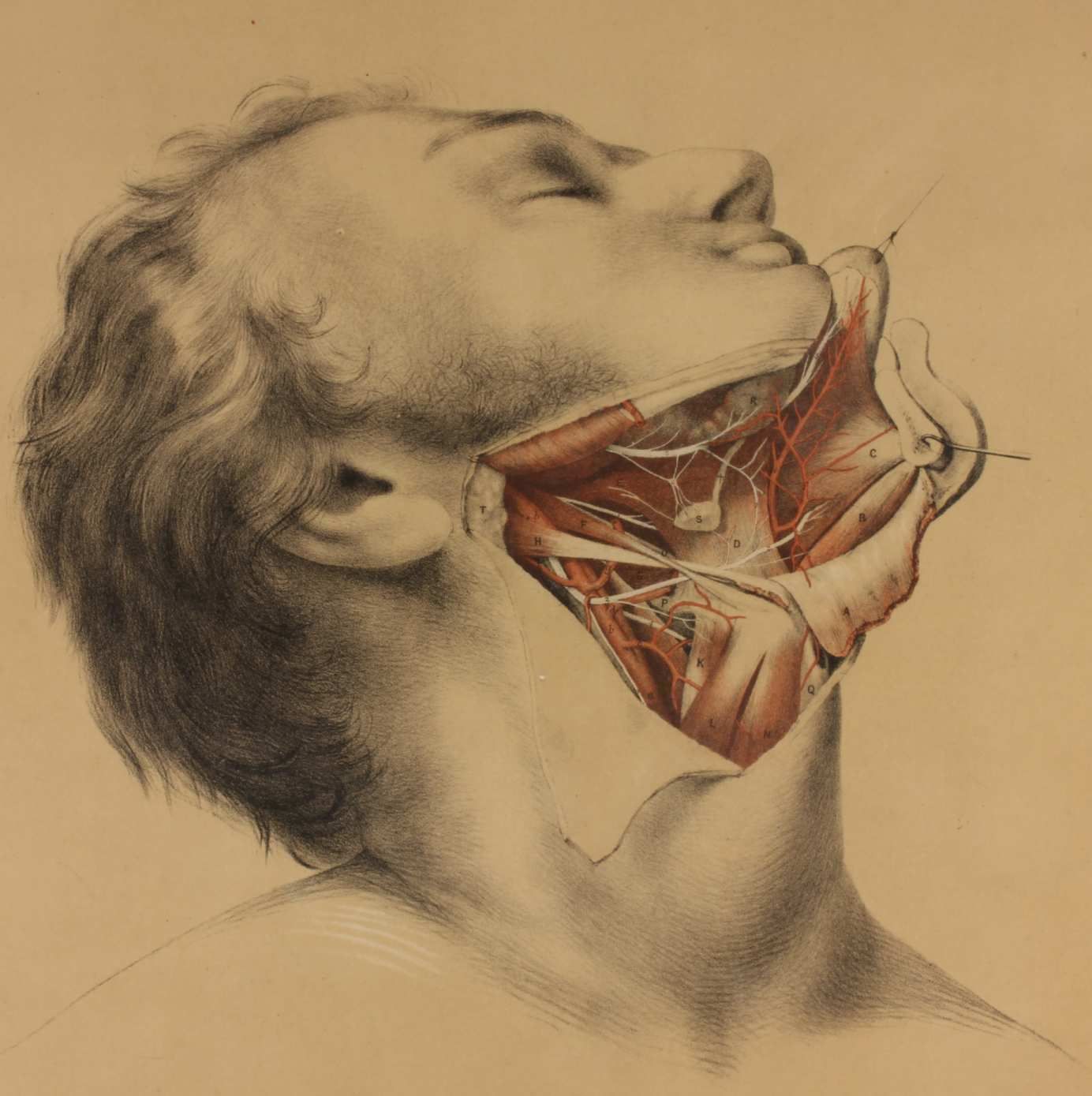350.0 Illustration Of Dissection Of Throat. Anatomy Lithograph. G Ellis 1864. photo