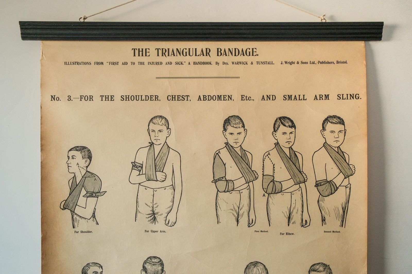 Original Anatomical Vintage British School Wall Chart Triangular Bandage Broken Bones Anatomy Wright & Sons First Aid Sling Arm Shoulder Hip photo furniture