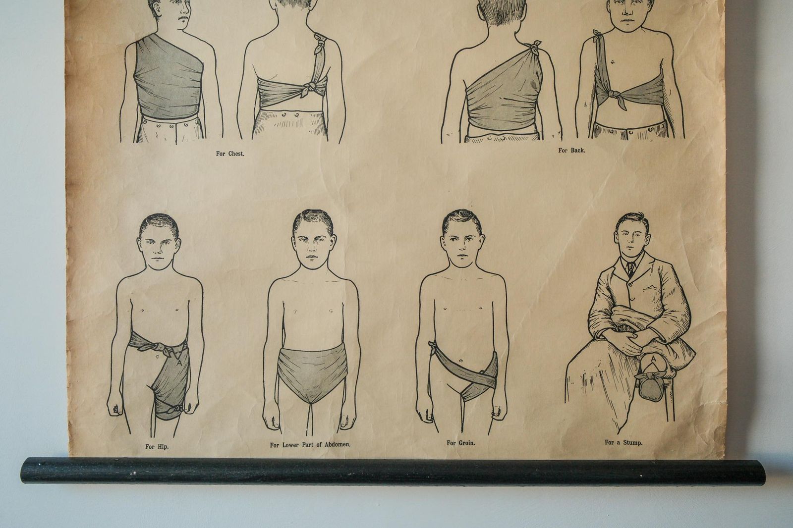 Original Anatomical Vintage British School Wall Chart Triangular Bandage Broken Bones Anatomy Wright & Sons First Aid Sling Arm Shoulder Hip photo Art