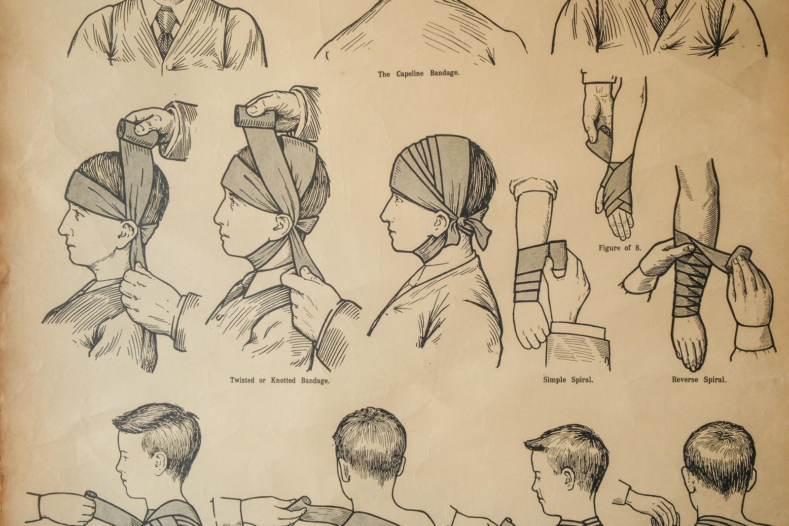 Original Anatomical Vintage British School Wall Chart Roller Head Bandage Broken Bones Anatomy Wright & Sons First Aid Shoulder Hip Chest photo for sale
