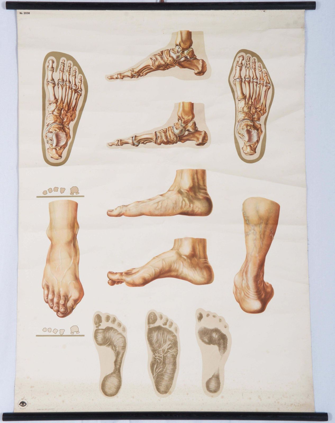Vintage Large German Medical Chart, Poster "Orthopedics Of Foot" photo furniture