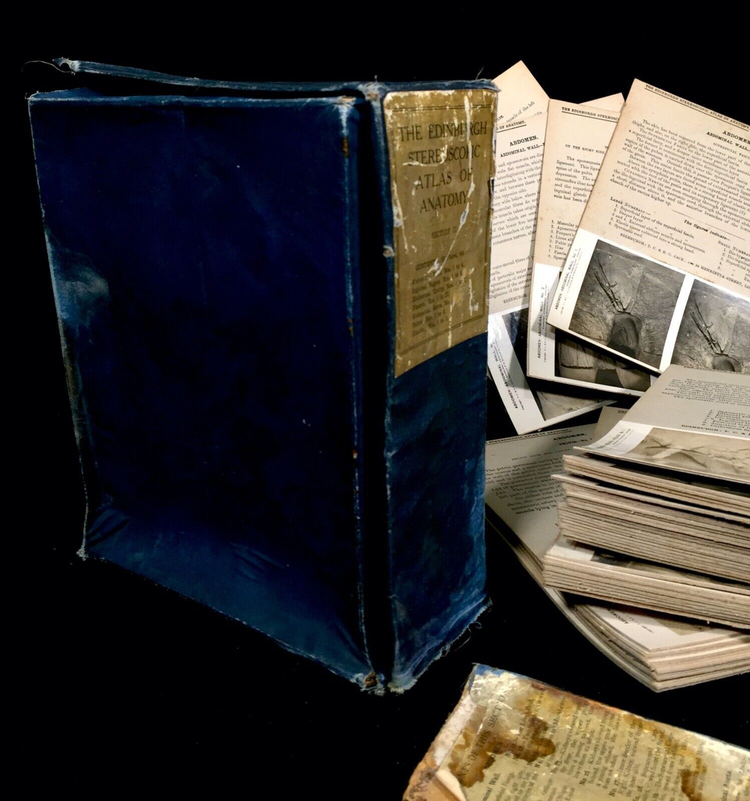 Art Antique Pair Of Boxed Edinburgh Stereoscopic Atlas Of Anatomy Cards Views C.1905 photo