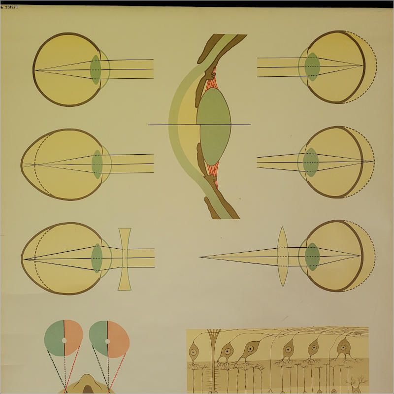 Vintage Large German Medical Chart, Poster “Eye II” photo vinterior
