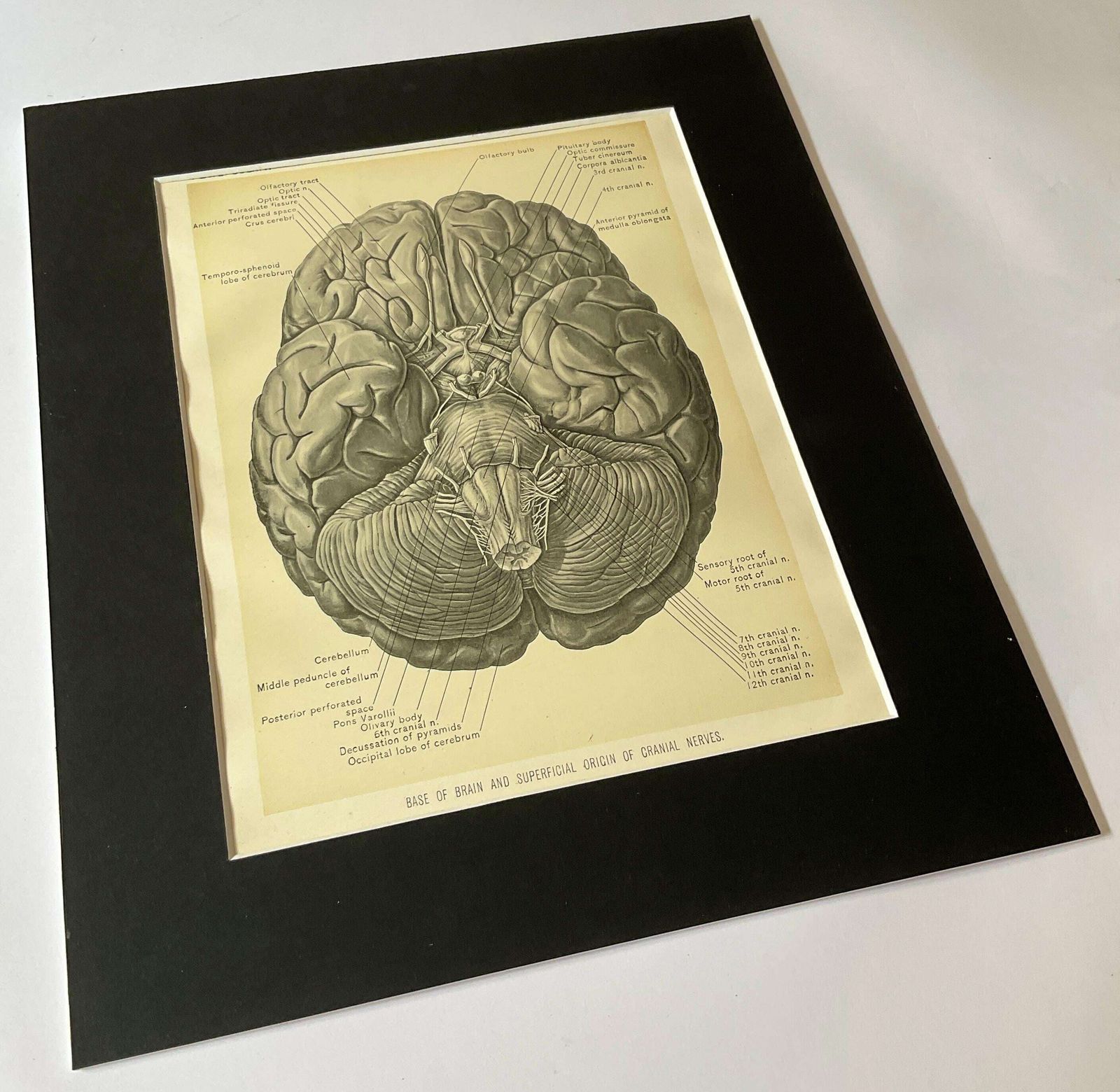 photo furniture Antieke anatomische gravures uit 1900. Wanddecoratie.