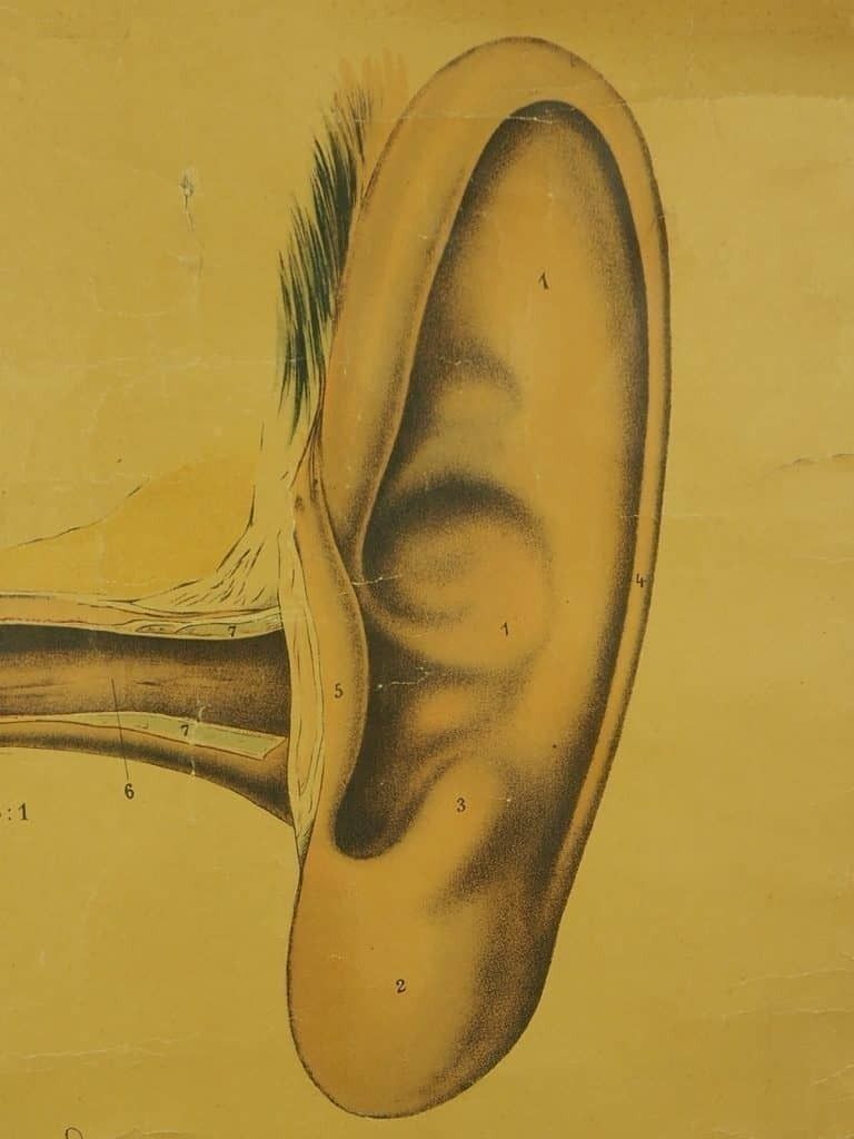 Antique Anatomical Chart (VI.) Human Anatomy Head Signed By E. Hoelemann photo 150.0