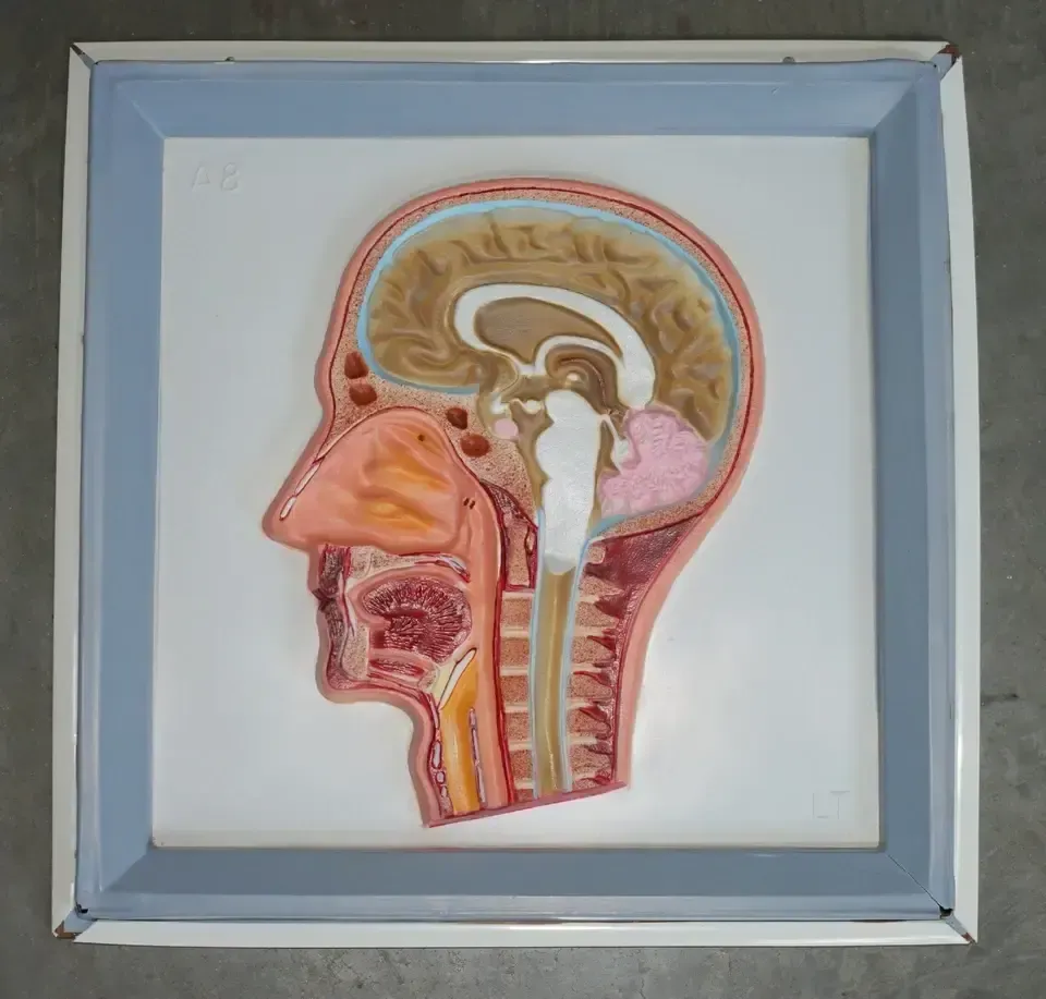 Set Of Five Vintage Educational Anatomical 3d Display Models Brain Iris Eardrum photo furniture