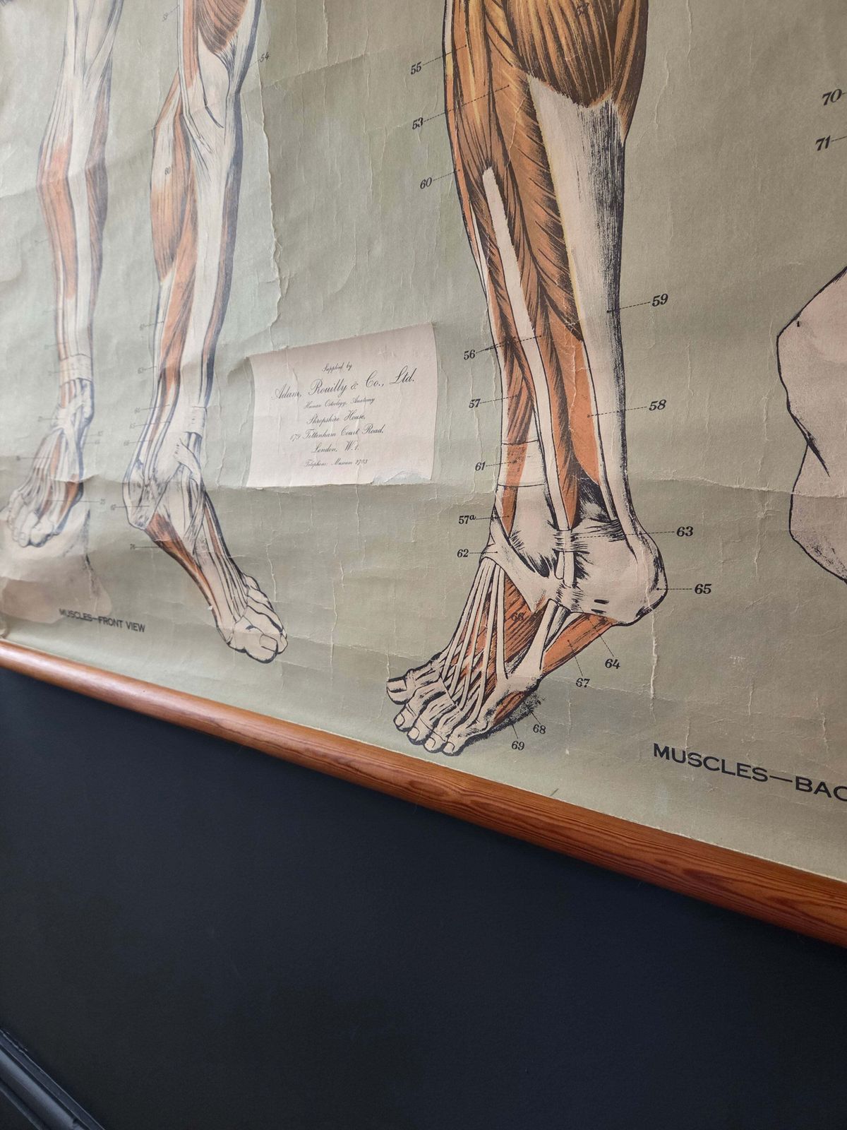 photo vinterior American Frohse Anatomical Chart Max Brodel Wall Hanging Poster By Adam, Rouilly & Co Medical