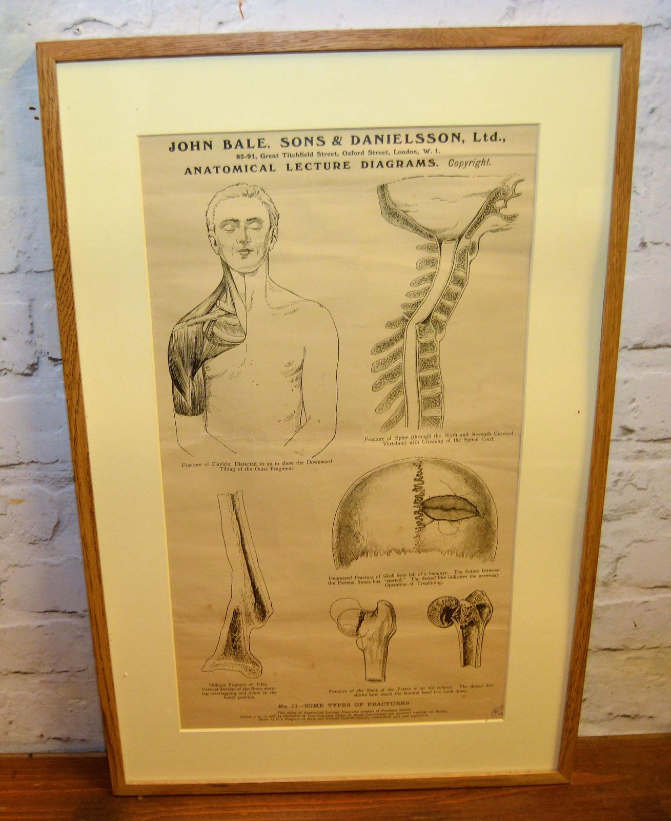 Anatomical Posters Charts Medical Vintage Macabre Wall Art Dentist Industrial Tattoo Mancave