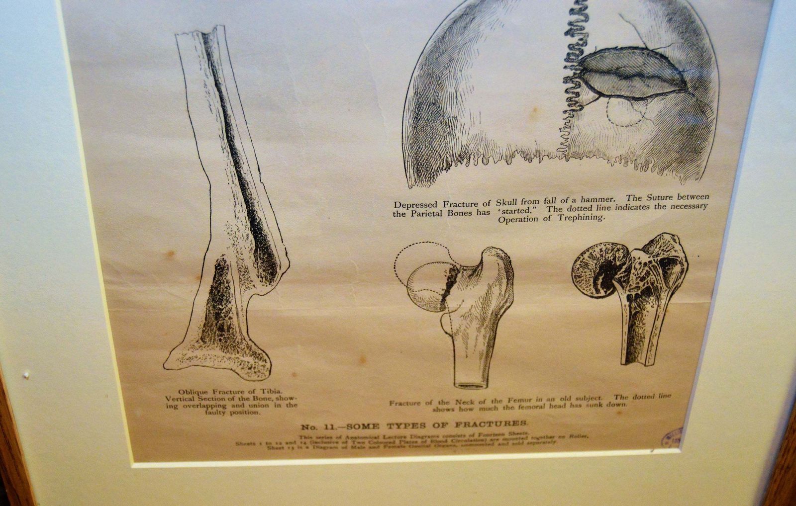 Anatomical Posters Charts Medical Vintage Macabre Wall Art Dentist Industrial Tattoo Mancave photo for sale