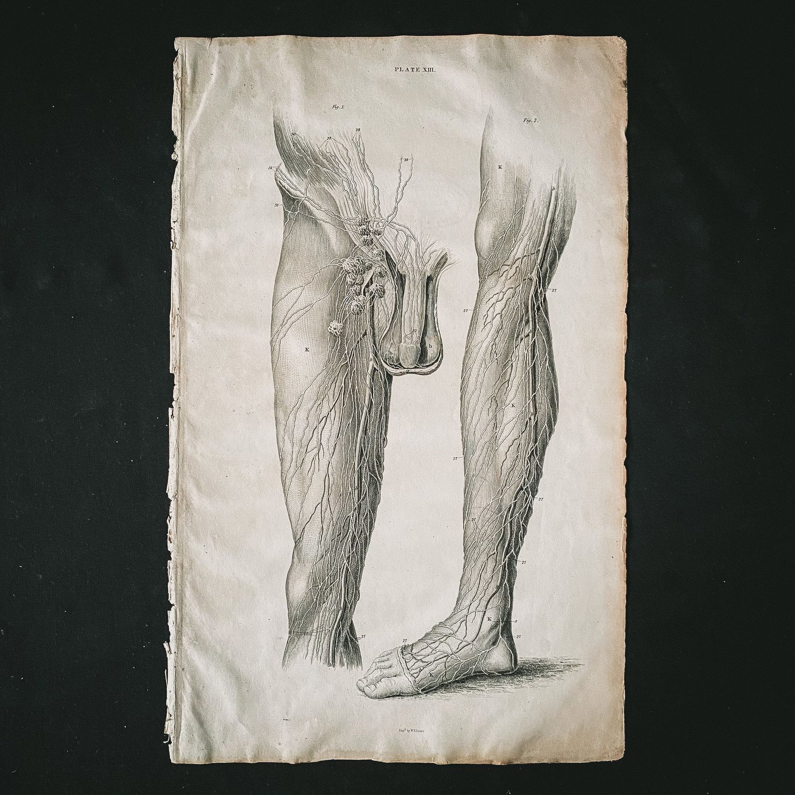 Anatomical Leg And Groin 1, Lizars 1824 'System Of Anatomical Plates' photo furniture