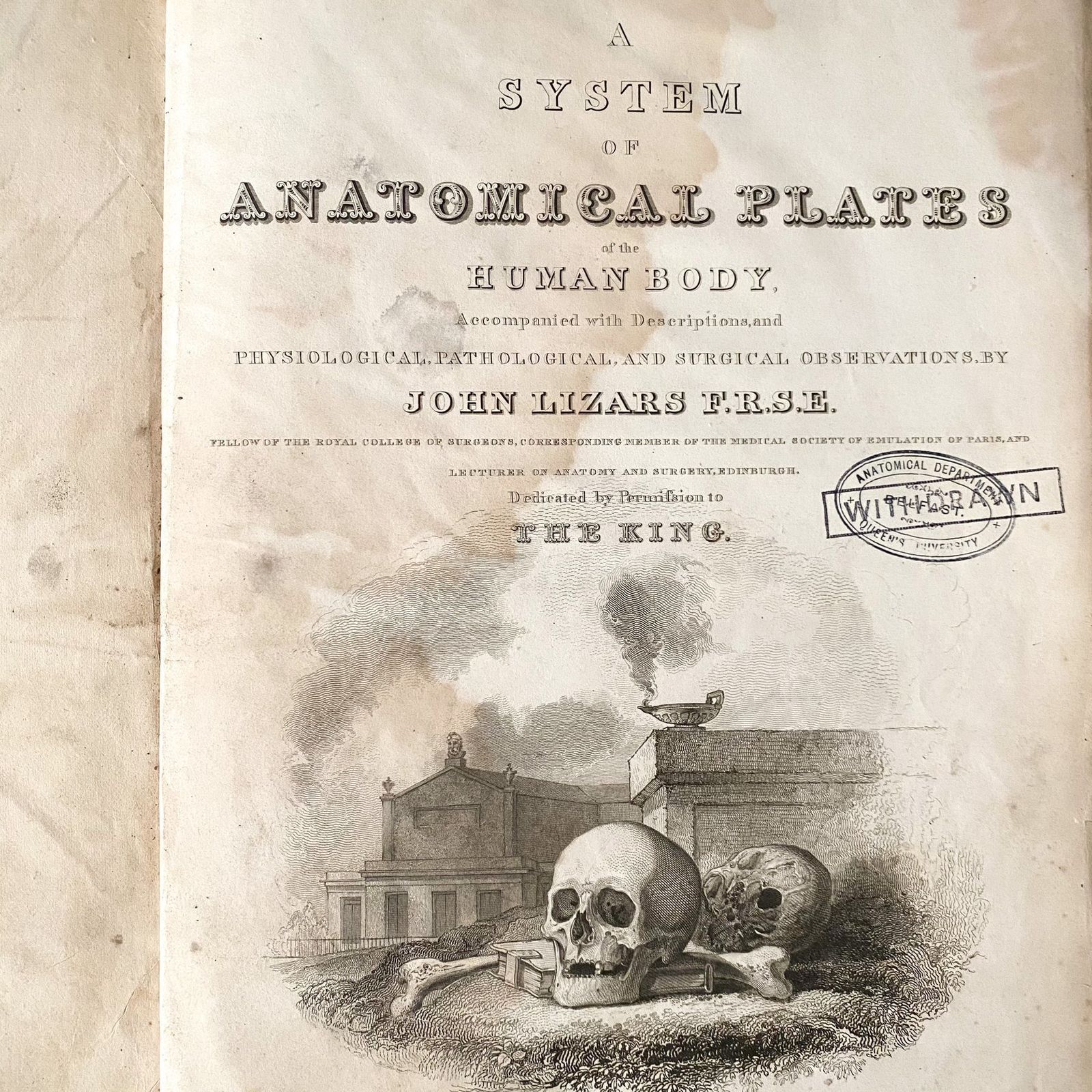 Anatomical Leg And Groin 1, Lizars 1824 'System Of Anatomical Plates' photo for sale