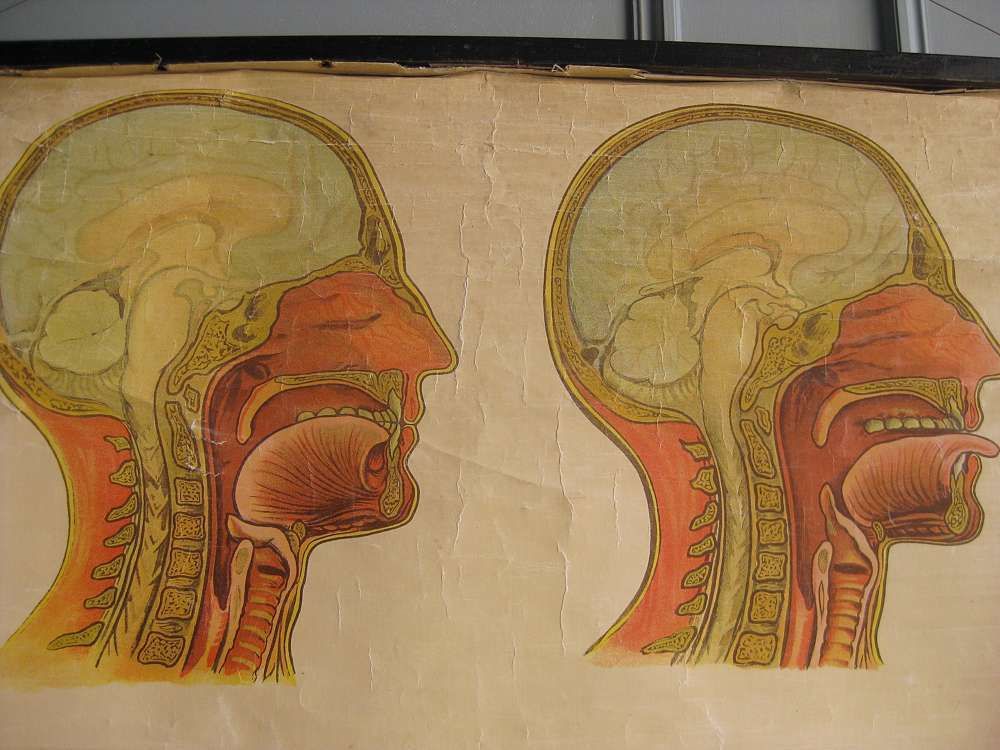 Early 20th Century Medical Resuscitation Poster photo buy