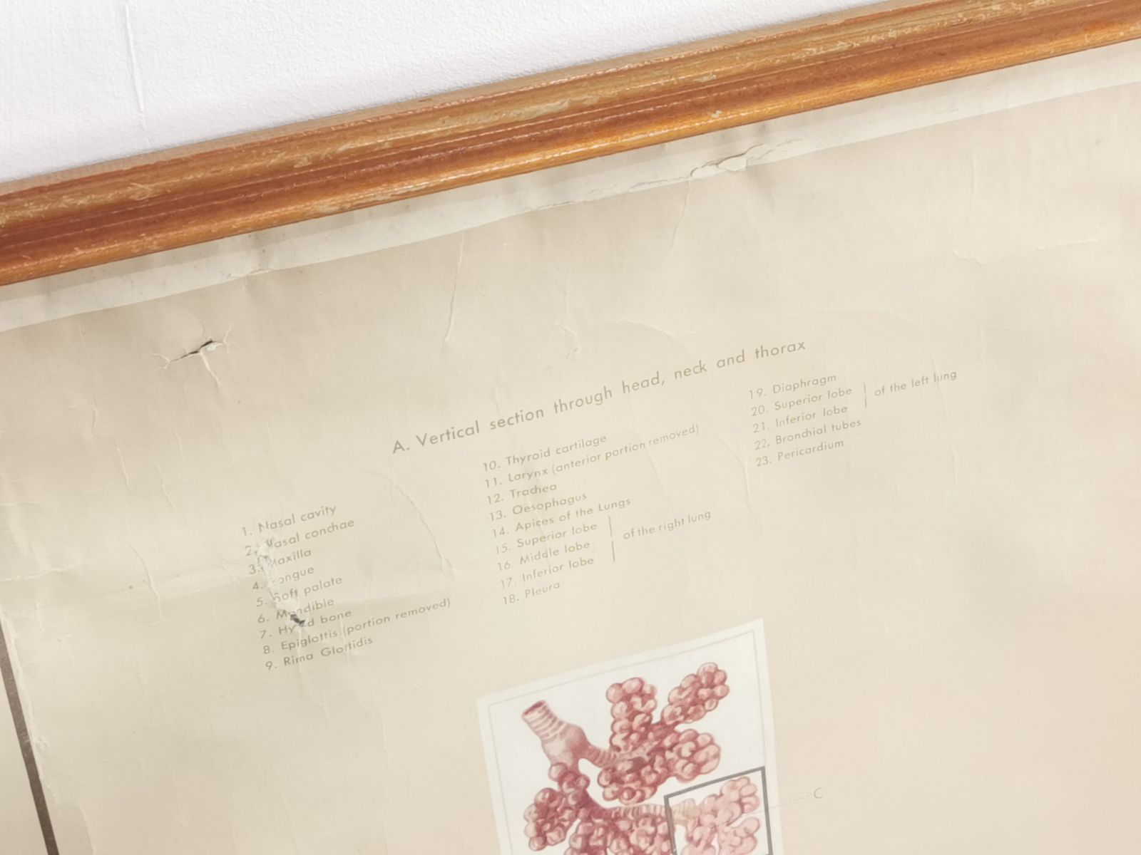 Respiratory Organ Medical Teaching Aid Poster By Adam Rouilly, 1940s. photo for sale