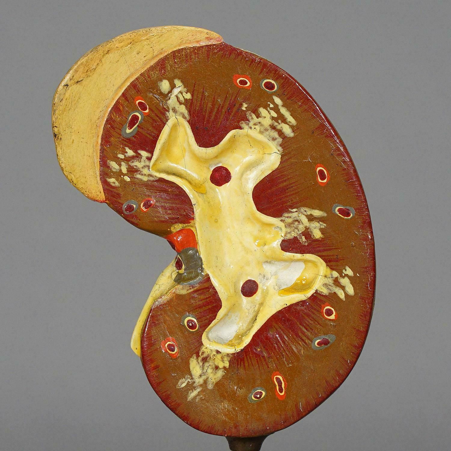 Antique Teaching Model Longitudinal Profile Of The Kidney, Ca. 1900 photo furniture
