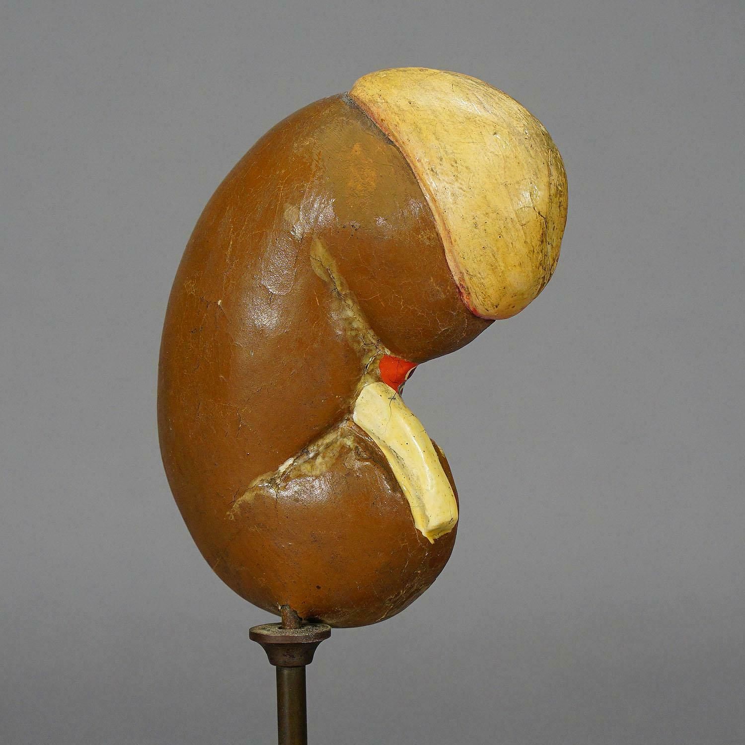 Antique Teaching Model Longitudinal Profile Of The Kidney, Ca. 1900 photo Art