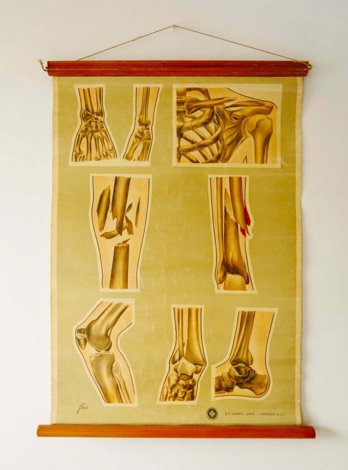 Original Anatomical Vintage British Educational School Wall Chart Bone Fractures Breaks Medicine St John's Ambulance Teck