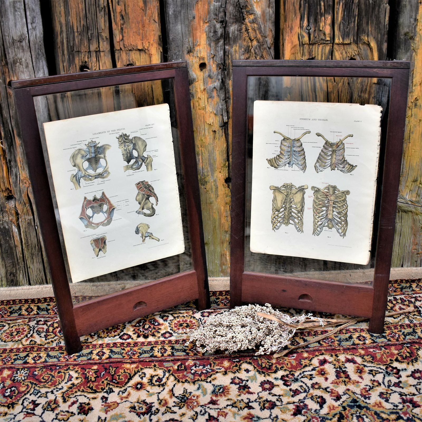 Antique 1885 W & Ak Johnston Human Pelvis Thorax Plate Print Museum Frame Pair