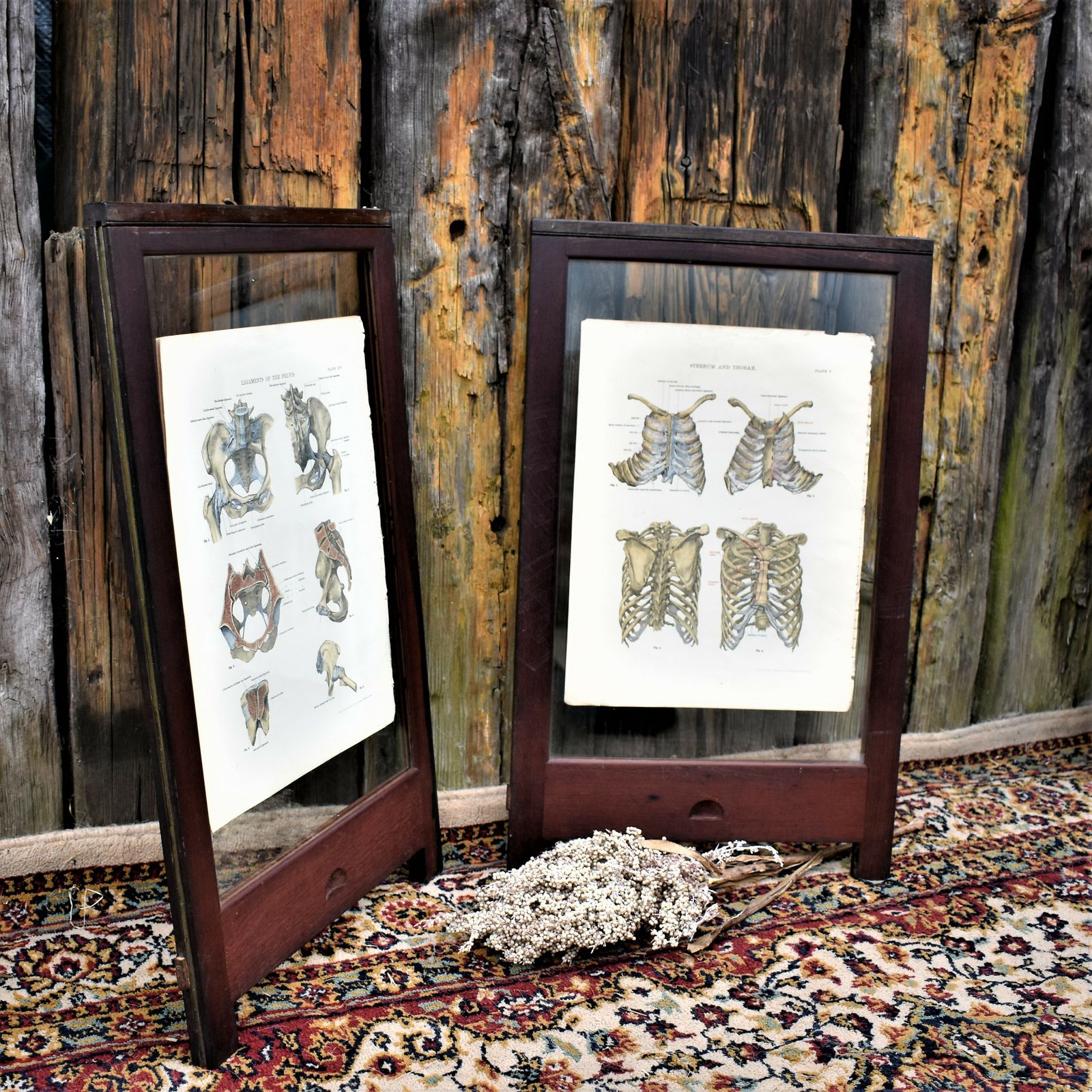 Antique 1885 W & Ak Johnston Human Pelvis Thorax Plate Print Museum Frame Pair photo furniture