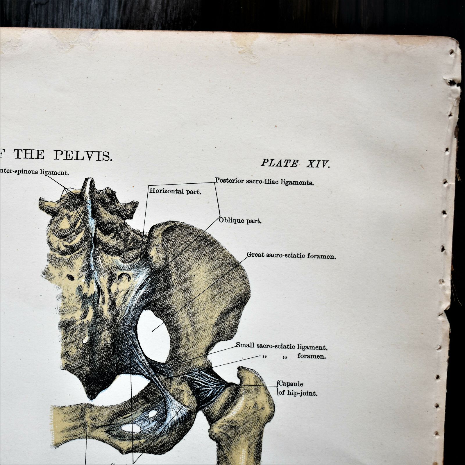 Antique 1885 W & Ak Johnston Human Pelvis Thorax Plate Print Museum Frame Pair photo Art