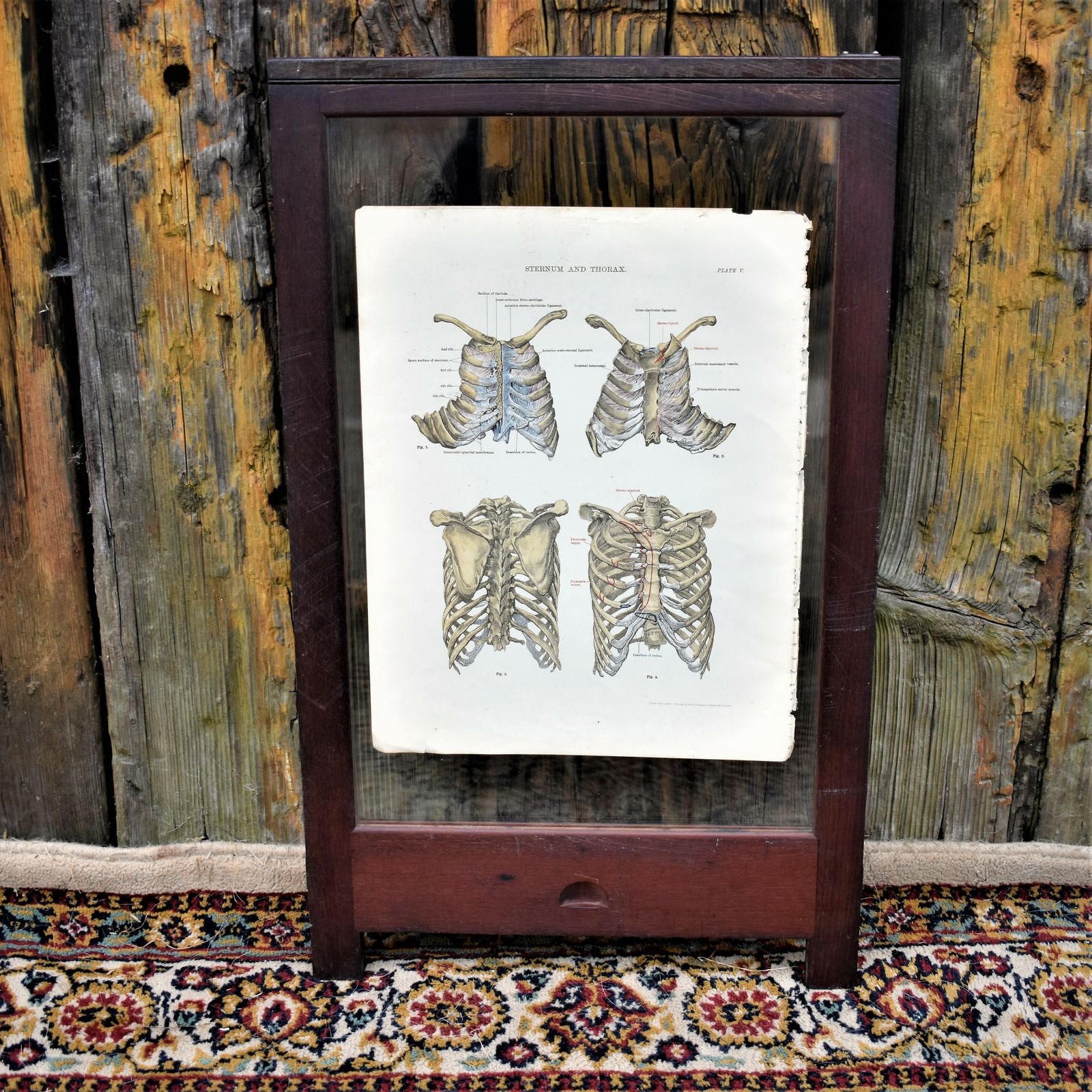 photo furniture Antique 1885 W & Ak Johnston Human Pelvis Thorax Plate Print Museum Frame Pair