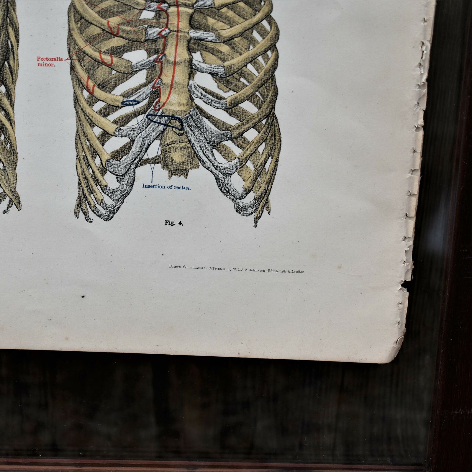 Art Antique 1885 W & Ak Johnston Human Pelvis Thorax Plate Print Museum Frame Pair photo