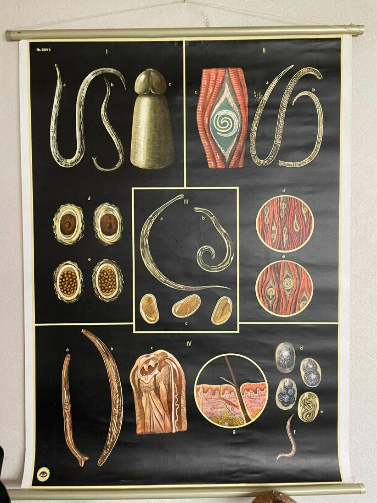 Vintage Gut Parasites Roll Down Educational School Chart Wall Chart Trichinosis photo furniture