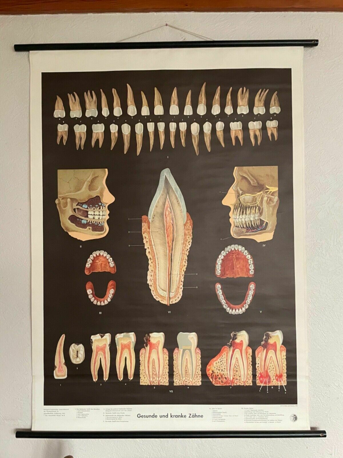 Vintage School Chart Teeth In Health & Disease Anatomy Educational Tooth Dental