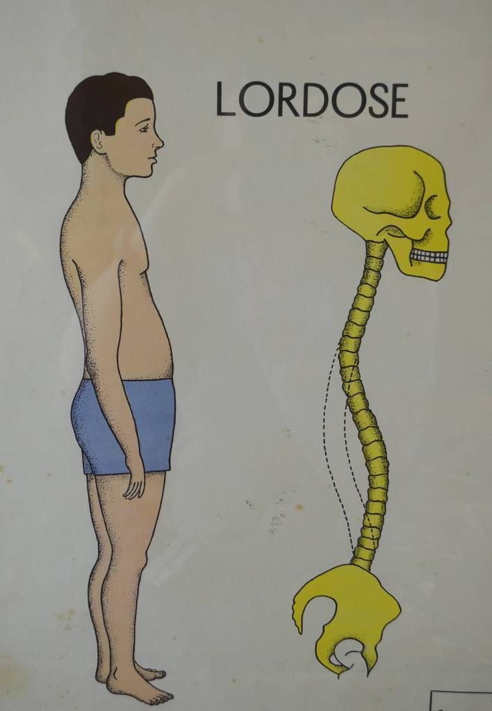 Mid Century French Medical Poster photo for sale