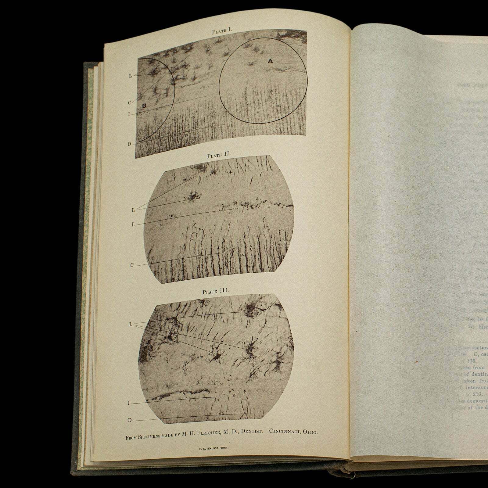 Set Of 2 Dentistry Books, English Language, Bound Medical Reference, Victorian photo Home Decor