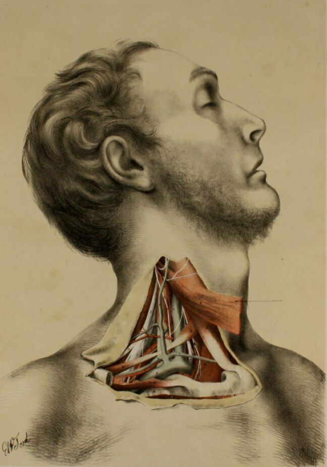 Original G Ellis Anatomy Lithograph Illustration Of Neck Dissection. 1864.
