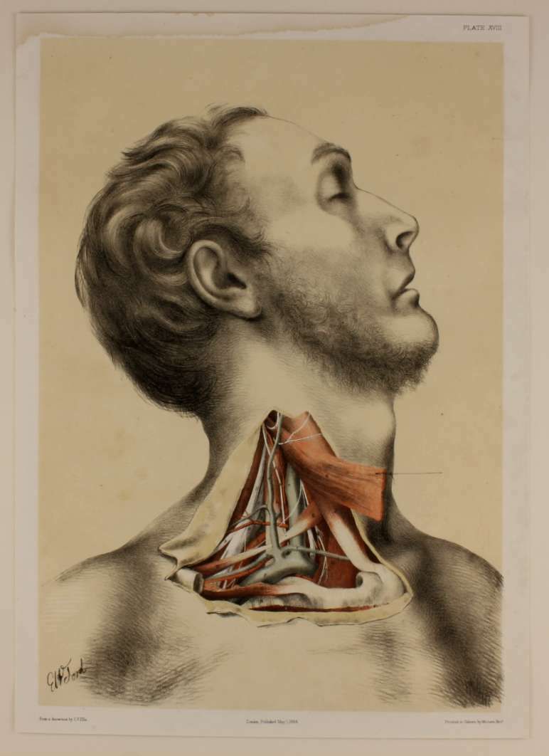 Original G Ellis Anatomy Lithograph Illustration Of Neck Dissection. 1864. photo vintage