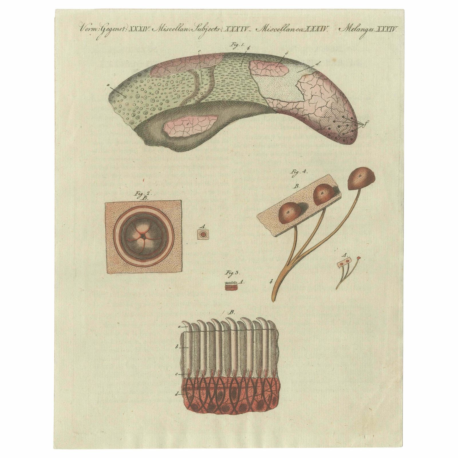 Antique Print Of The Examination Of A Beef Tongue Of A Cow