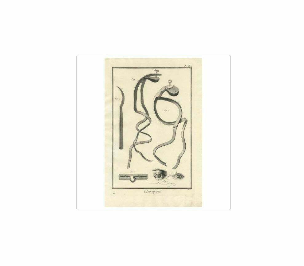 Antique Medical Print ‘Pl. Xxii’ By D. Diderot, Circa 1760 photo furniture