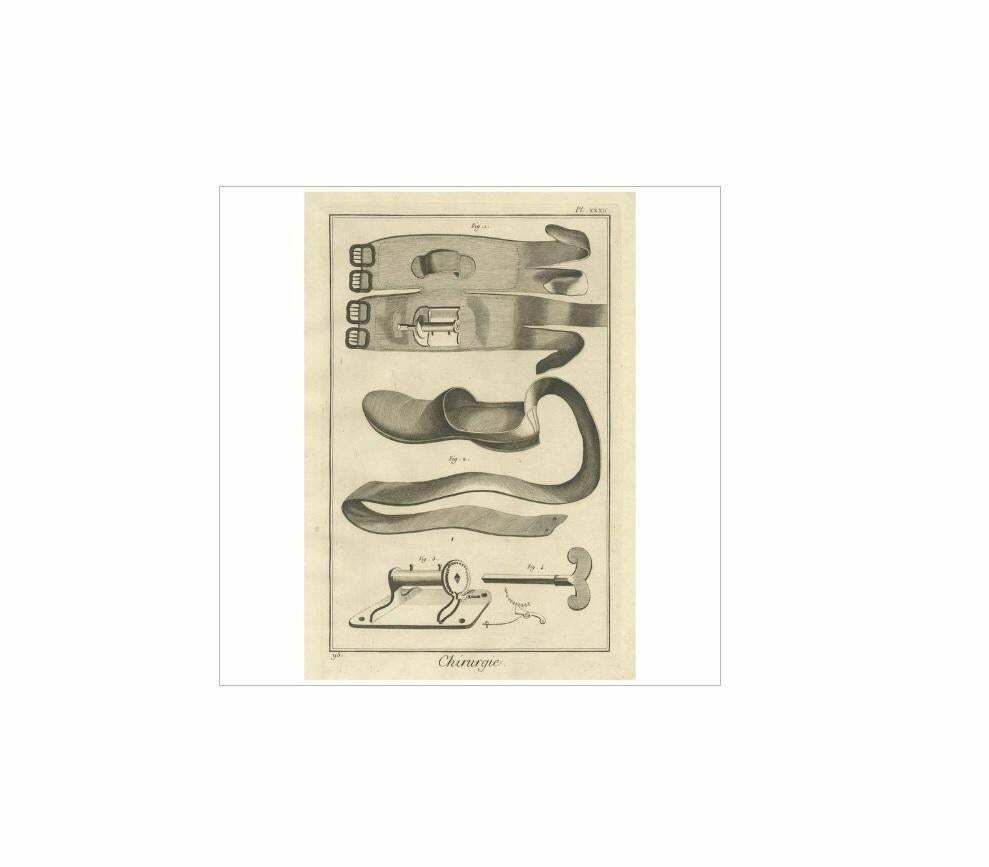 Antique Medical Print 'Pl. Xxxii' By D. Diderot, Circa 1760 photo for sale