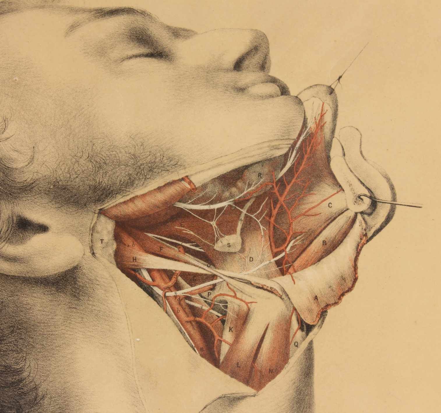 Illustration Of Dissection Of Throat. Anatomy Lithograph. G Ellis 1864. photo Art