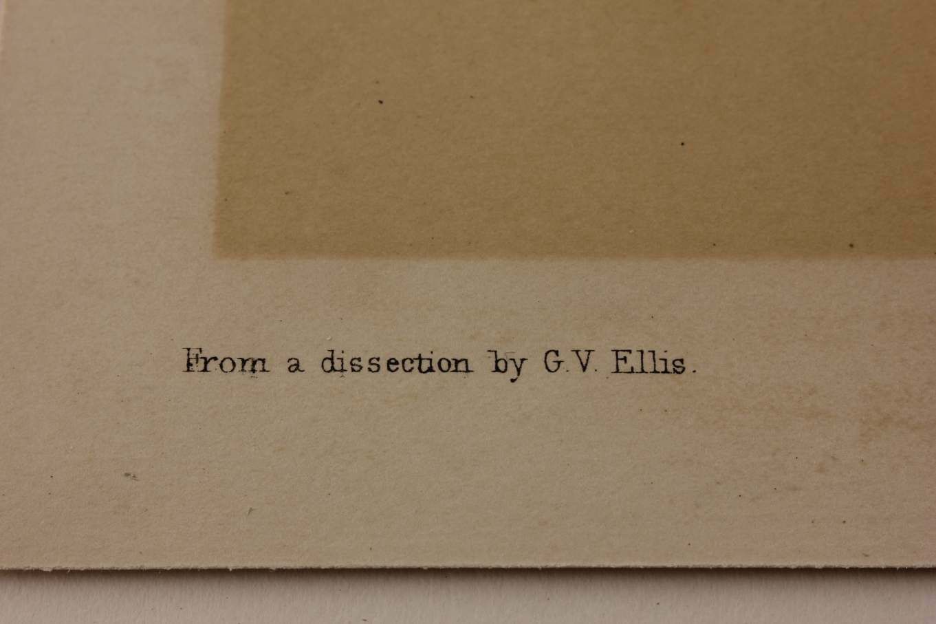 Illustration Of Dissection Of Throat. Anatomy Lithograph. G Ellis 1864. photo 350.0