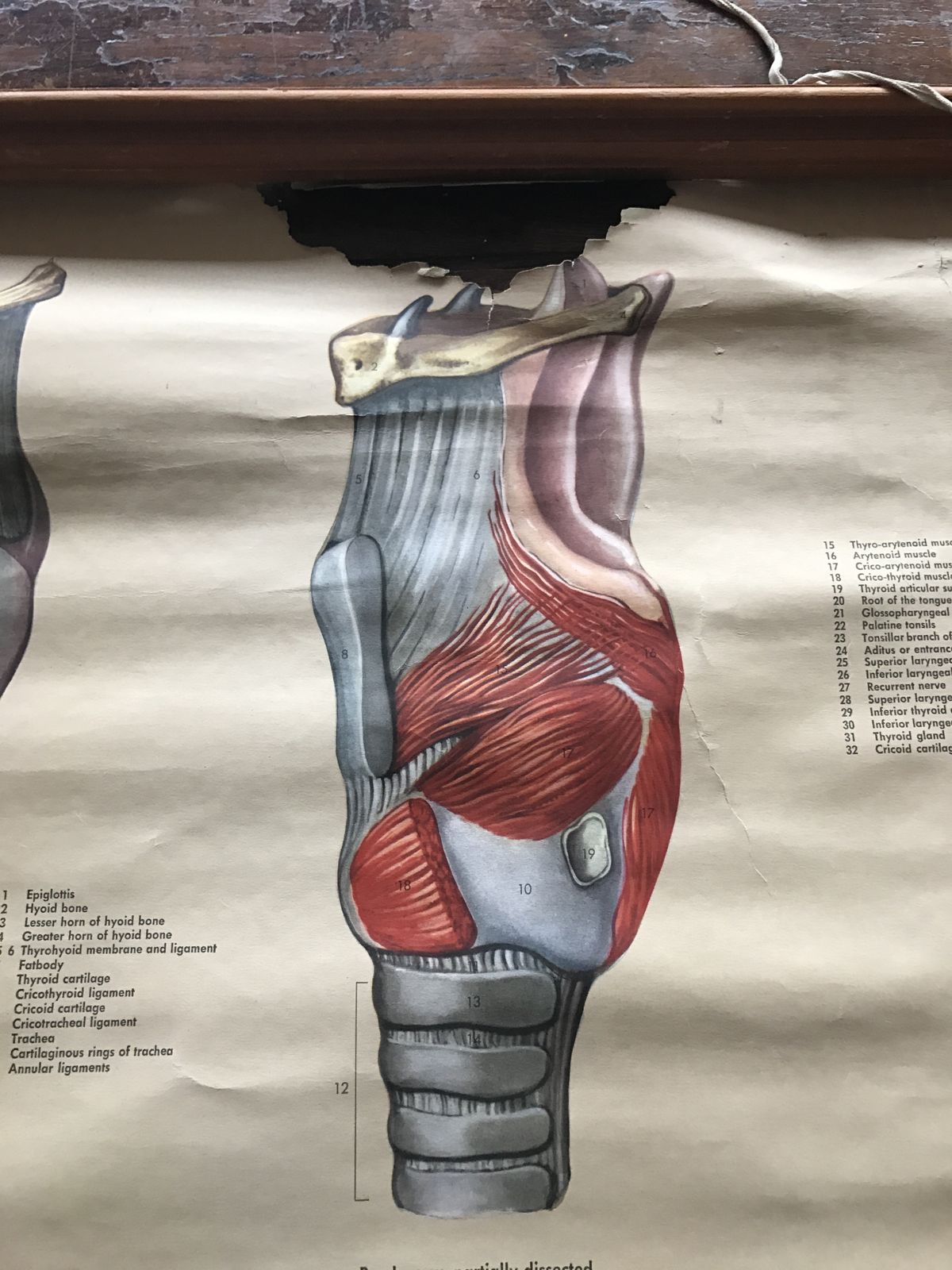 Early To Mid 20th Century Medical Anatomical Chart Showing Head And Throat photo furniture