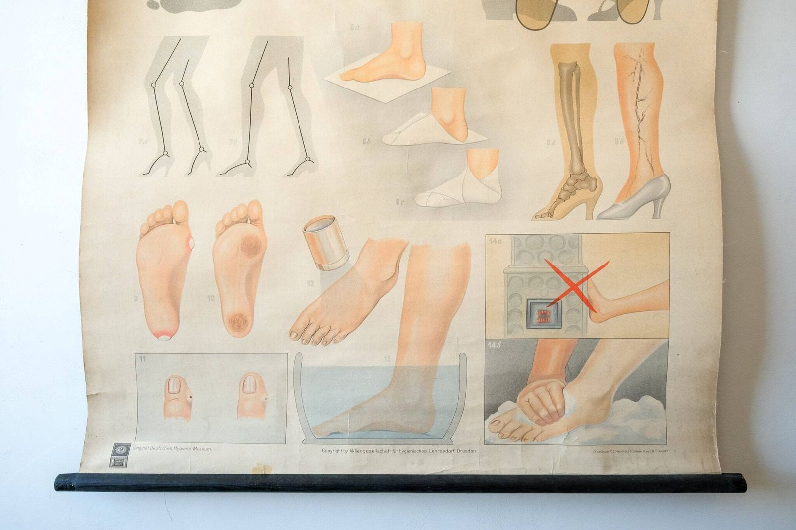 Original Anatomical Vintage German Educational School Wall Chart Foot Care Feet Bones Anatomy Medicine Deutsches Science Museum Rare photo for sale