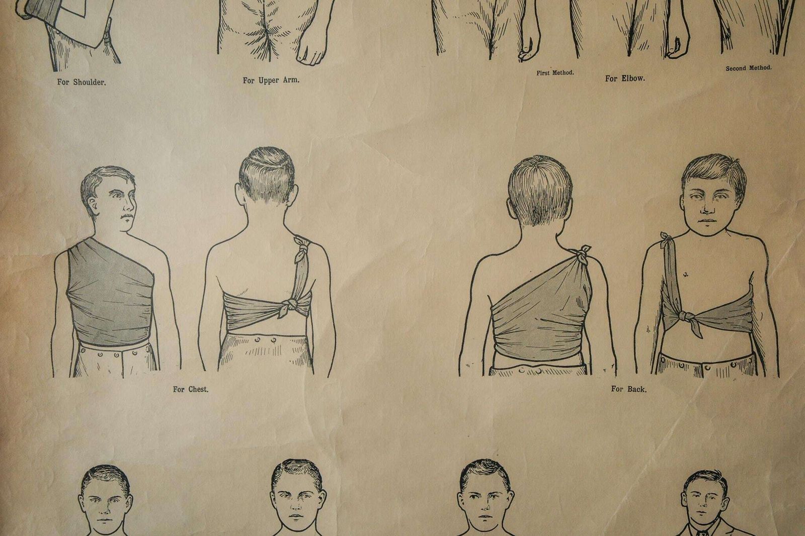 Original Anatomical Vintage British School Wall Chart Triangular Bandage Broken Bones Anatomy Wright & Sons First Aid Sling Arm Shoulder Hip photo for sale